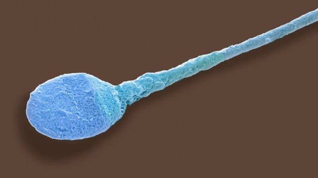 All About Azoospermia (No Sperm Count)