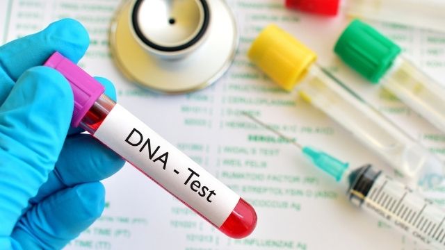 DNA Fragmentation Testing All About Sperm DNA Fragmentation Test