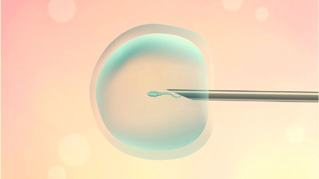 All About ICSI (Intracytoplasmic Sperm Injection)