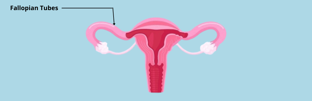 Can fallopian tubes cause miscarriage
