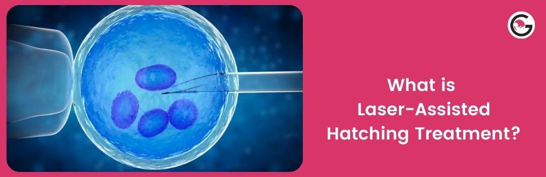 is Laser-Assisted Hatching Treatment | Gunjan IVF World