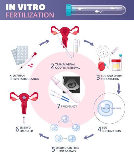 what-is-ivf-image