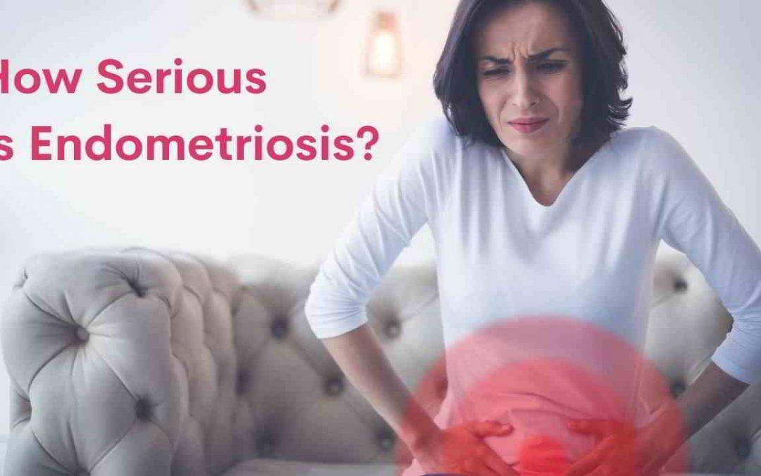 How Serious Is Endometriosis?