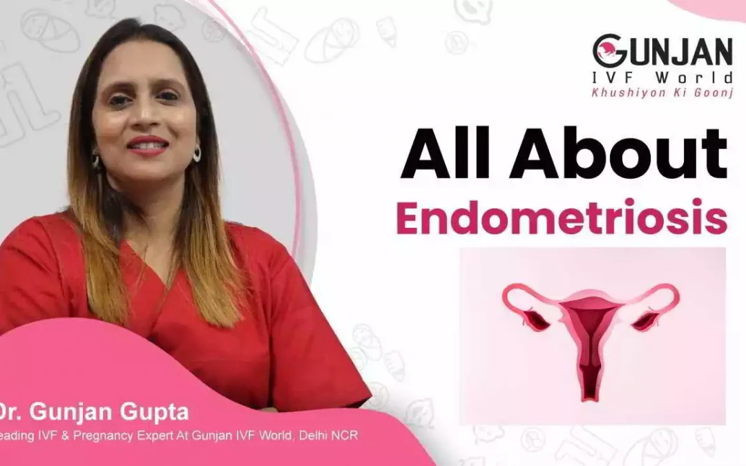 All About Endometriosis