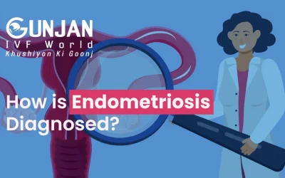 How is Endometriosis Diagnosed?