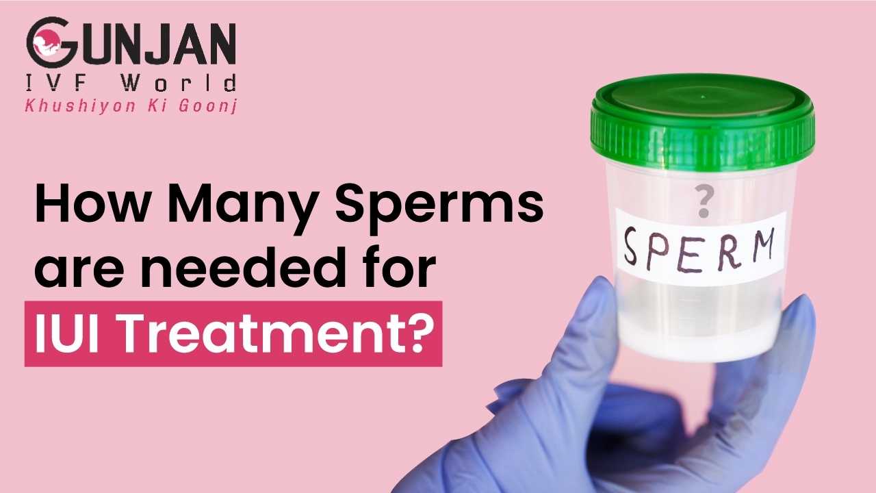 How Many Sperm are needed for IUI? Facts You should know