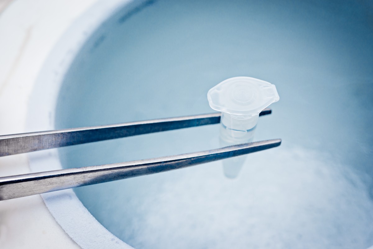 Things you need to know when considering egg freezing